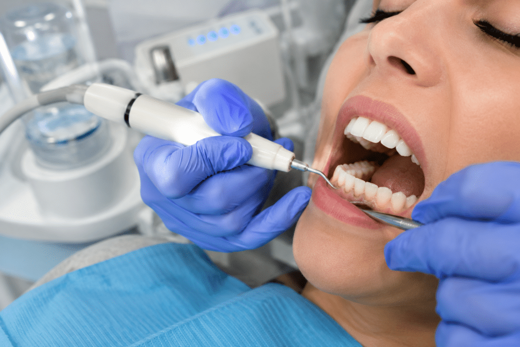 igienizarea dentară profesională în timpul procedurii de curățare