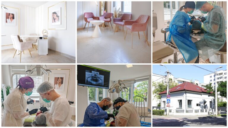 procedura implant dentar la Dental Chic Cluj-Napoca